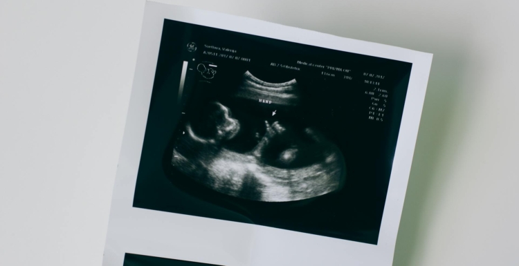 A Life Is a Life No Matter How Small: 7th Grader’s Pro-Life Poem Goes Viral A Life Is a Life No Matter How Small: 7th Grader’s Pro-Life Poem Goes Viral
