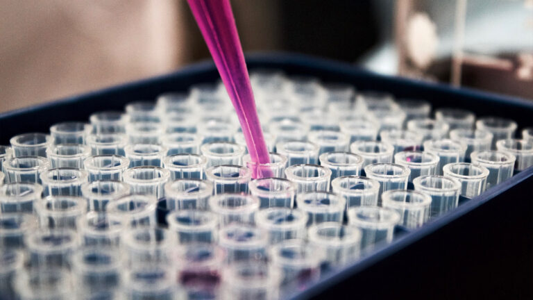 U.S. Presses Moscow for Answers After Mysterious Death at Russian Pathogen Lab